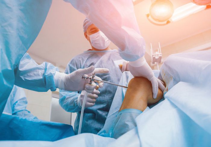 Artroskopia kolana – na czym polega zabieg i jak długo trwa powrót do zdrowia?
